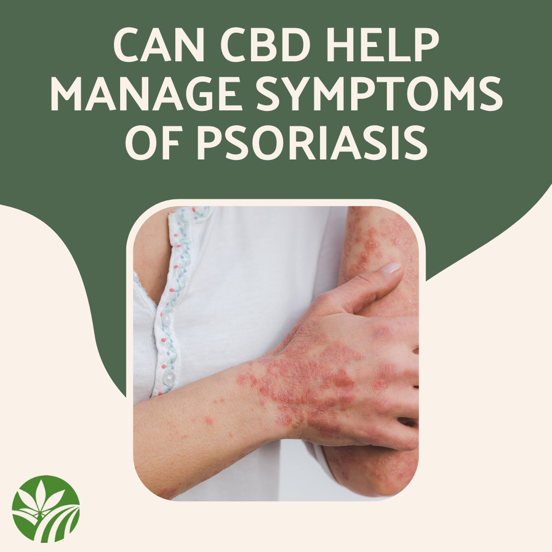 The Use of CBD for Psoriasis - Oley Hemp